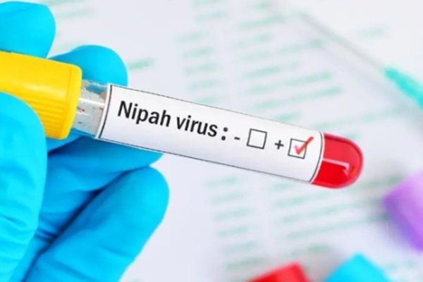 केंद्र ने केरल सरकार को निपाह वायरस के प्रसार को नियंत्रित करने के लिए जन स्‍वास्‍थ्‍य उपायों को तत्‍काल लागू करने की सलाह दी